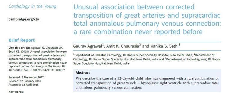 Unusual association between corrected transposition of great arteries and supracardiac TAPVC
