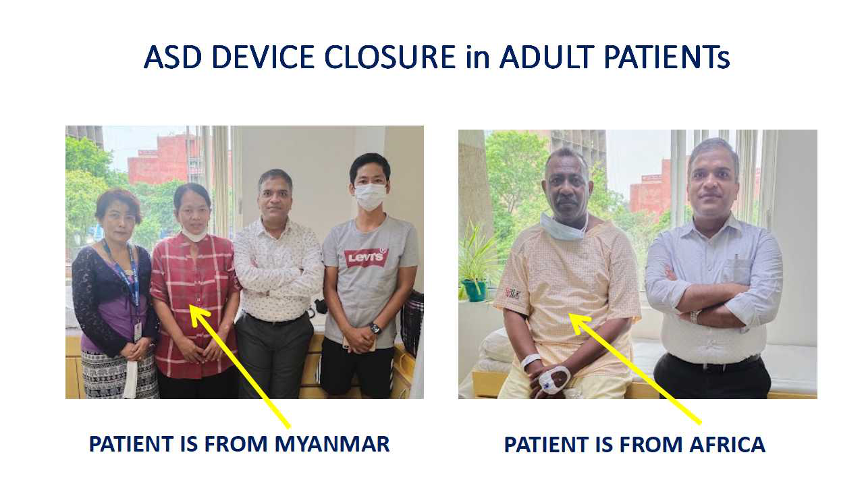 ASD Device Closure - two adult patients