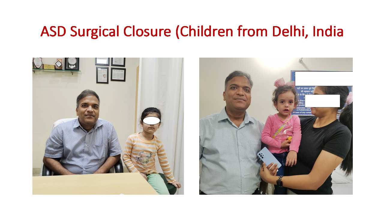 ASD Surgical Closure