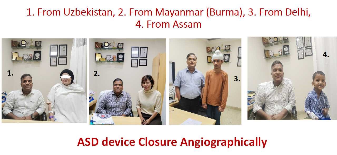 ASD Device Closure - 3 international patients